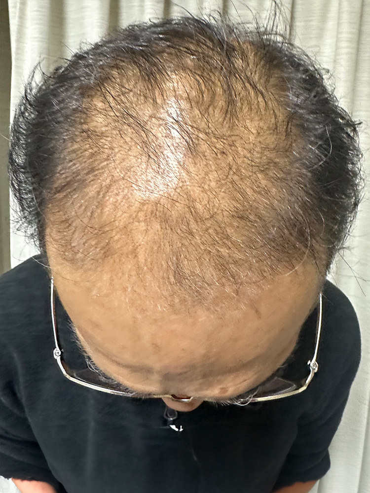 改善事例のご紹介