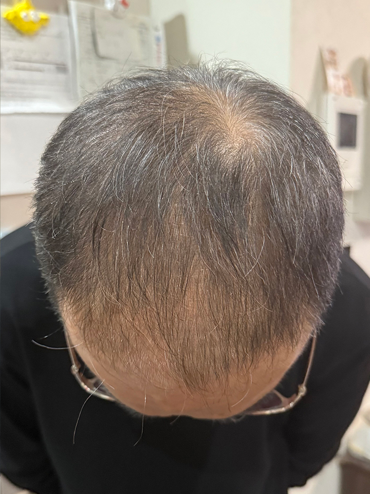 改善事例のご紹介