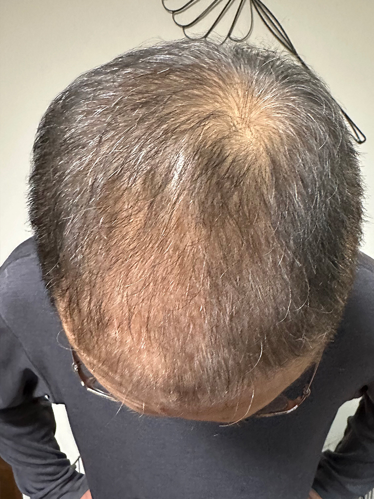 改善事例のご紹介