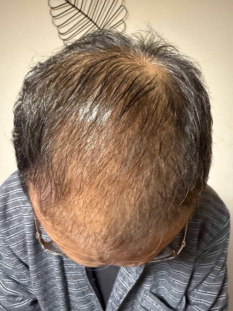改善事例のご紹介