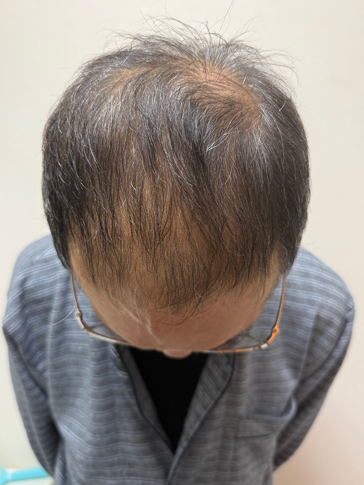 改善事例のご紹介