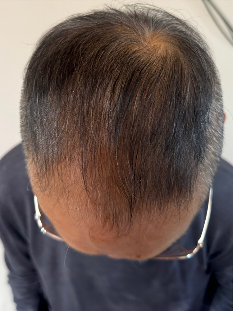 改善事例のご紹介